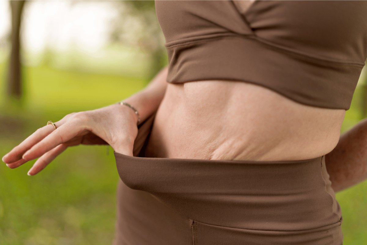 Woman showing loose skin on her belly after weight loss