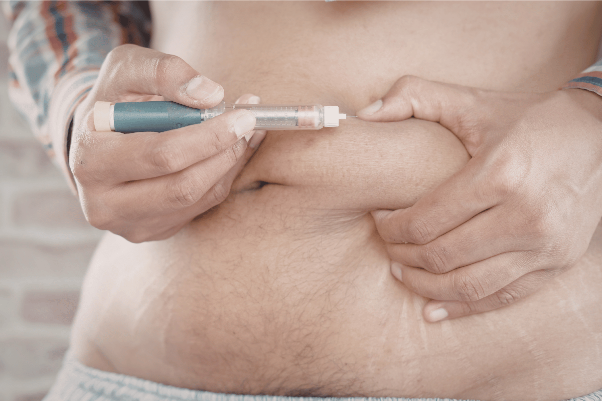 Best Place to Inject Ozempic: Injection Sites & Tips Explained